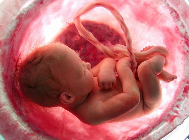 retraso de crecimiento prenatal