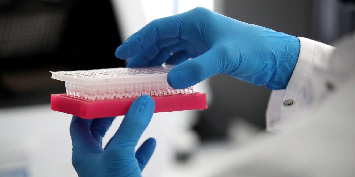 Chemical and Veterinary Investigation Office supports the state of North Rhine-Westphalia with COVID-19 tests